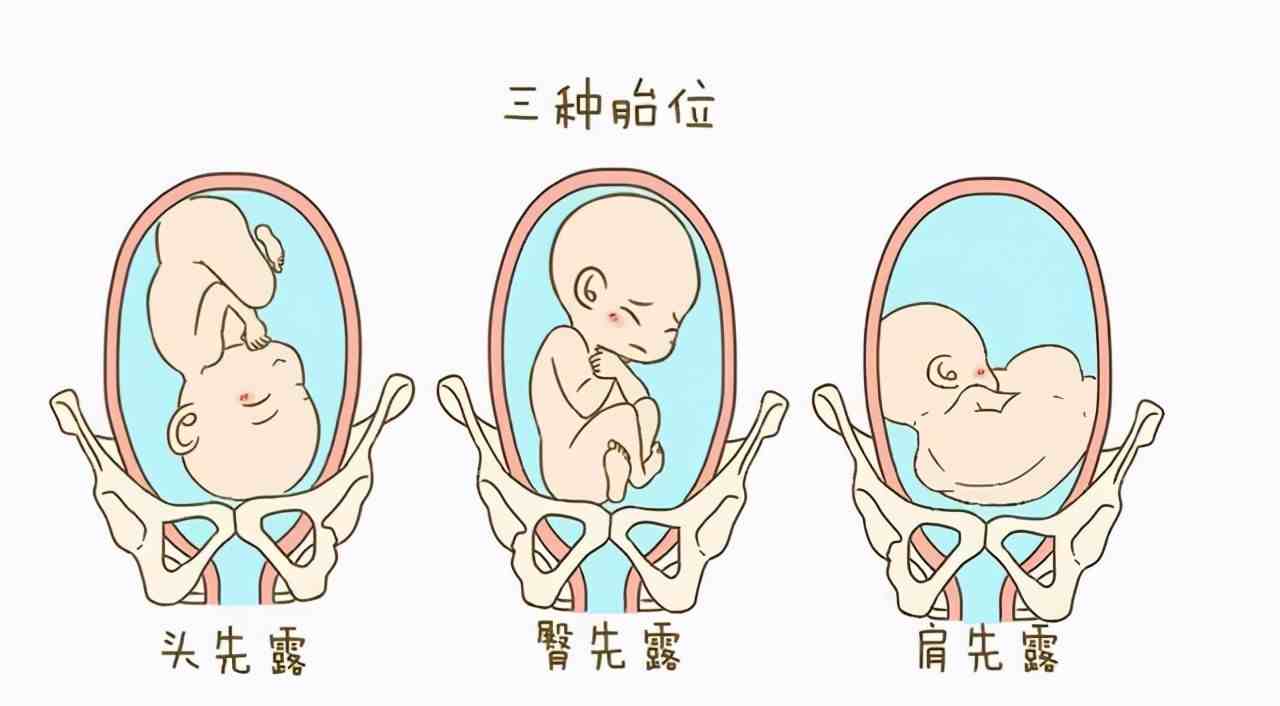 胎位roa胎儿在子宫中到底有多少姿势