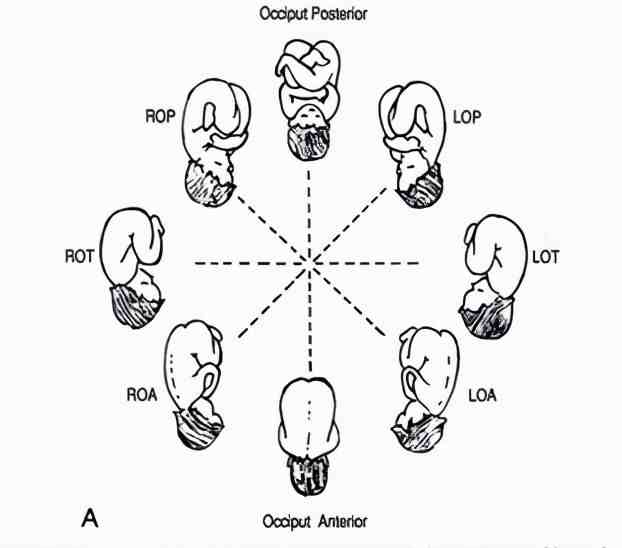 胎位roa胎儿在子宫中到底有多少姿势