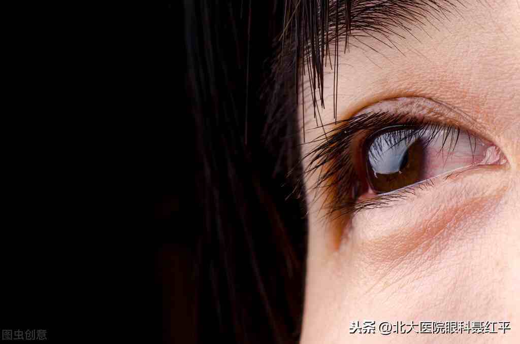 眼睛红红的像出血一样是怎么回事(眼红是怎么回事?