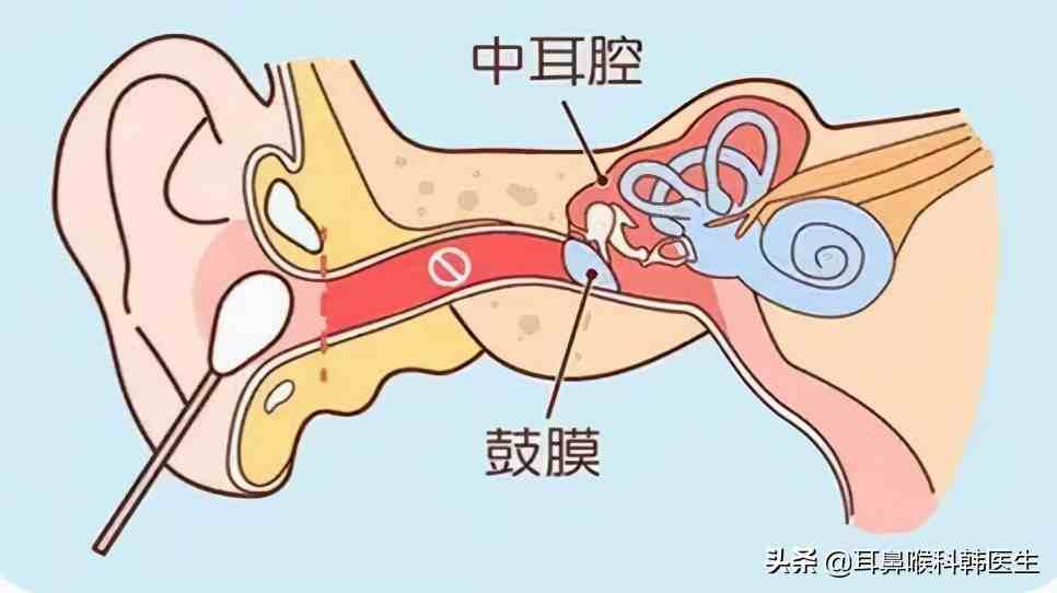 耳膜穿孔多久鼓膜穿孔能洗澡吗