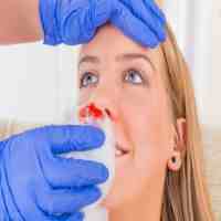 流鼻血是什么原因（鼻子出血是如何引起的）