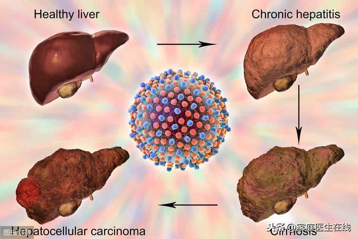 肝癌的早期症状会有哪些？身体出现这6种情况要小心