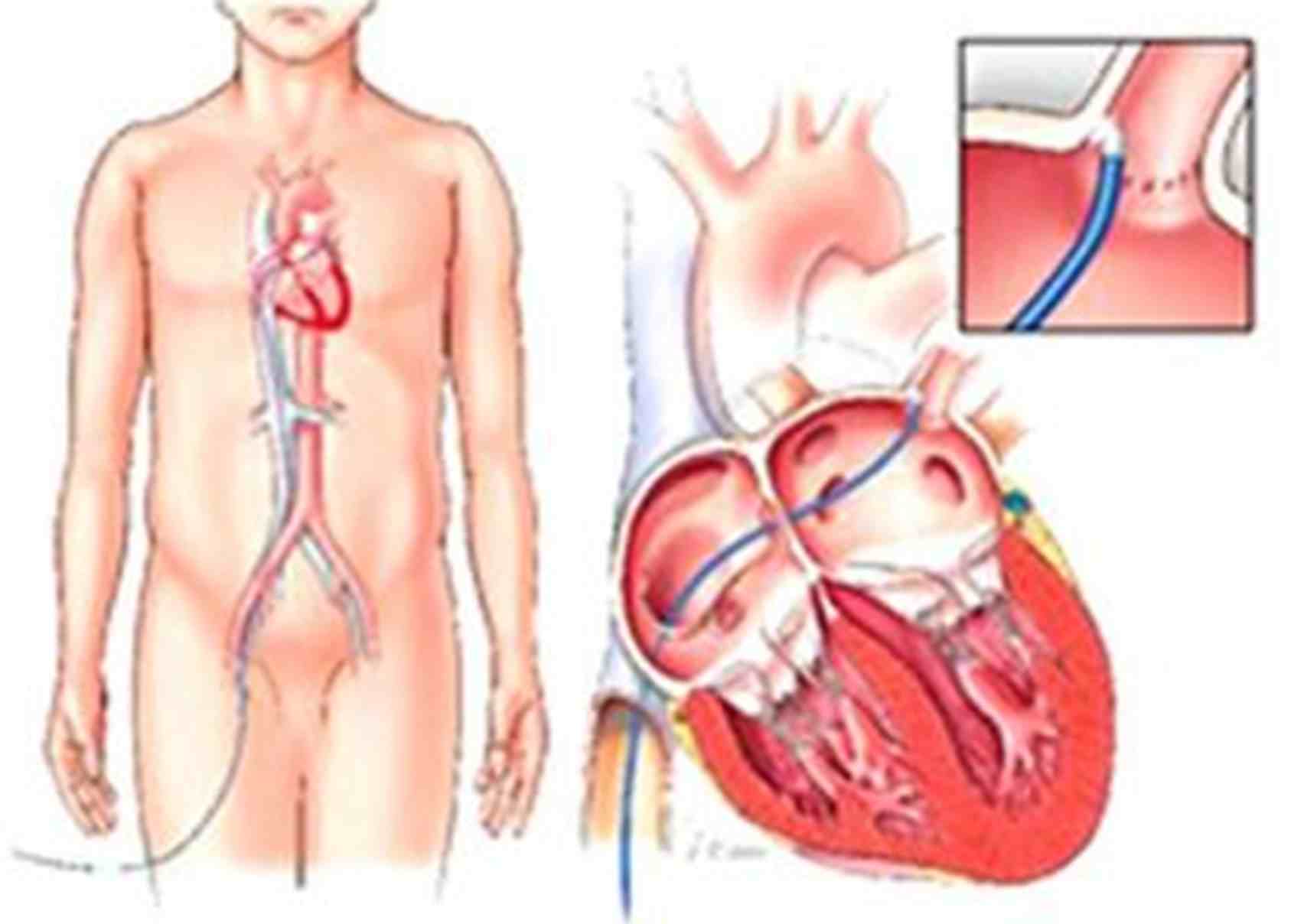 正常的心律是怎样的？什么是心律失常？