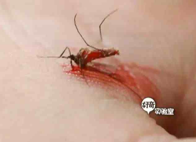 这可能是史上最全的灭蚊攻略！