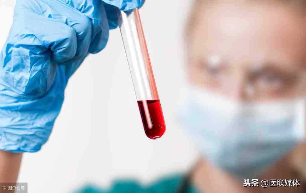 看懂血常规检查：白细胞增多，可能暗示这一个问题