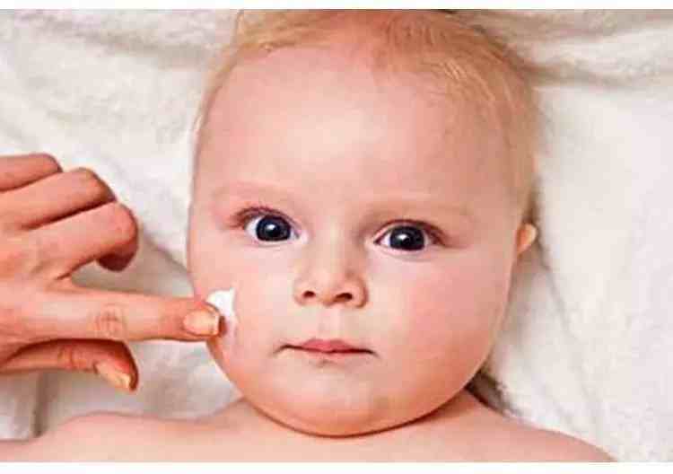 如果你或孩子得湿疹了，湿疹膏怎么选？（看这篇就够了）