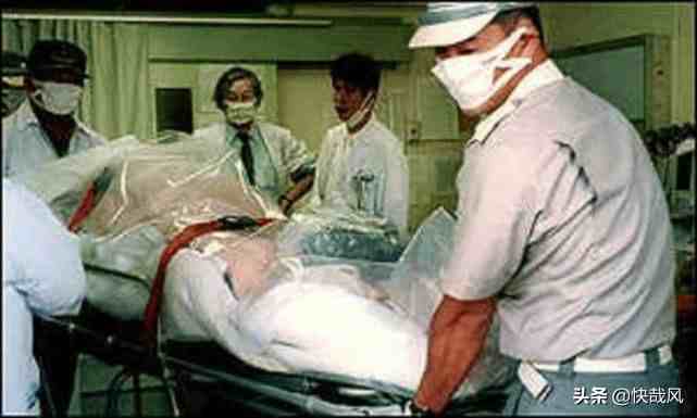 史上最惨的死亡：此日本人核辐射后想安乐死，医生硬让他活了83天
