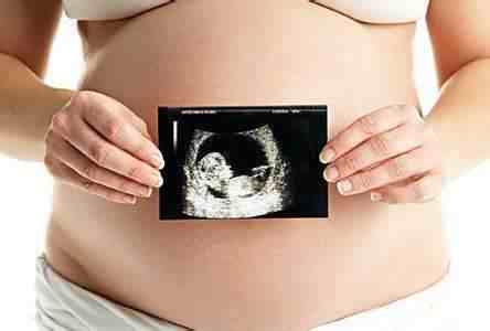 胎儿肾积水|胎儿膀胱大是不是畸形