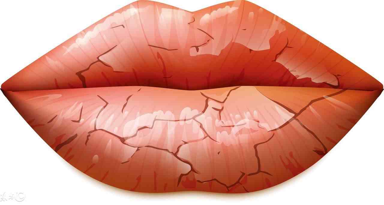 为什么嘴唇越舔越容易干裂？嘴唇起皮怎么去处理？