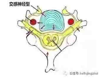 颈椎压迫神经|颈椎压迫神经能自愈吗