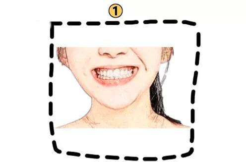 牙齿相学|六种牙齿六种命