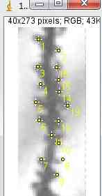 快速树突棘密度分析方法及细胞计数