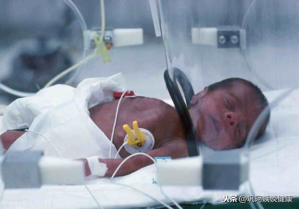 新生儿呼吸窘迫综合征的识别及管理策略