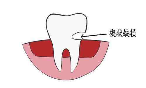 口腔健康｜那些牙科医生的忠告，最后一条从来没人听