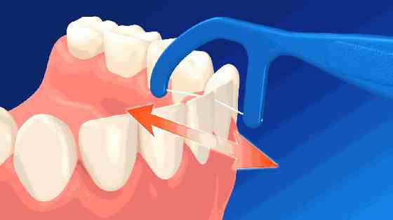 三种牙线的正确使用方法对比，你看懂了吗？