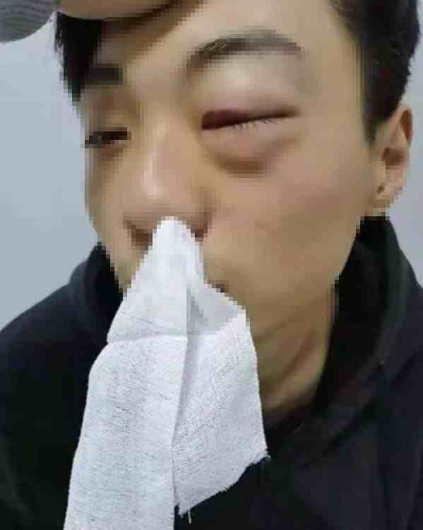 河南一中专生遭老师殴打险些失明，校方要求其把“被打伤”修改为“不慎摔伤”，并向公安机关申请撤案