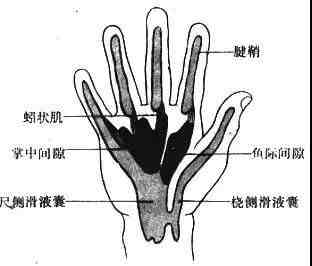 保龄球戴戒指什么意思|打保龄球姿势不正确，有人因此手指断裂！