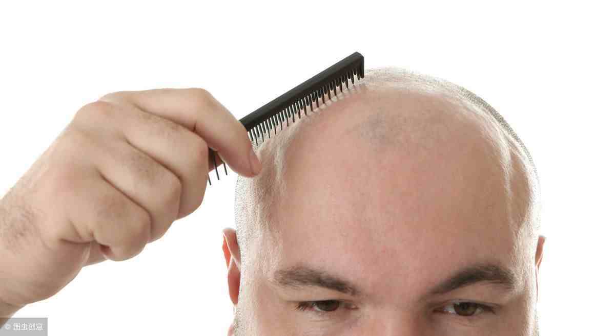 每天掉多少头发算正常|人正常每天掉几根头发？