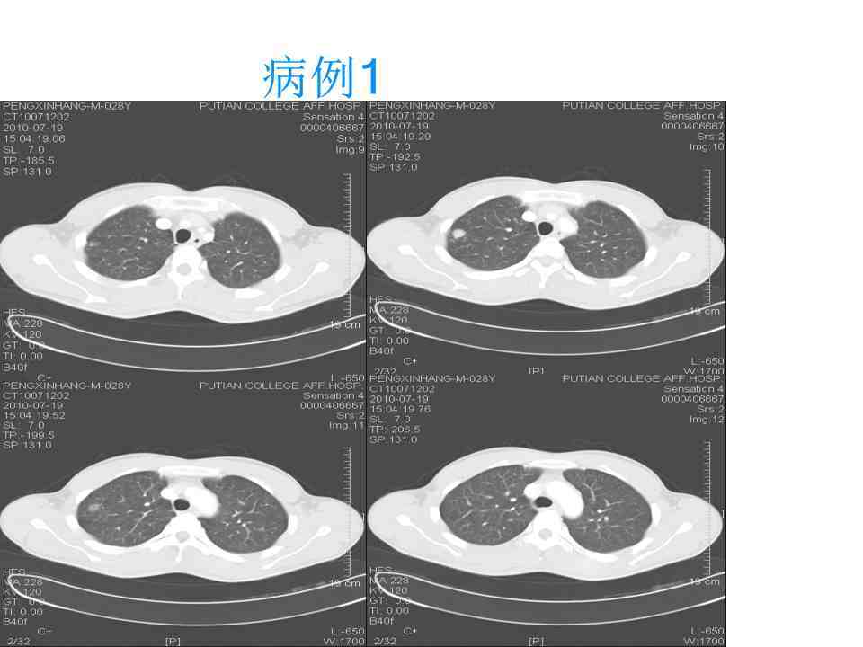 常见临床病例精解|病例挑战 | 经典病例诊断