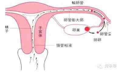 get ✔ 备孕遇到输卵管畸形，具体应该怎么办呢？