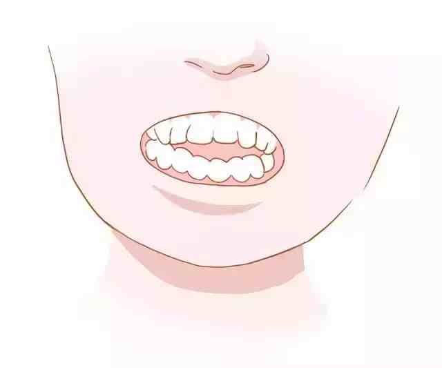 牙齿矫正对颜值有多大影响？附案例证明