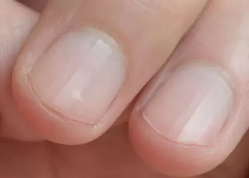 指甲上的月牙代表什么？