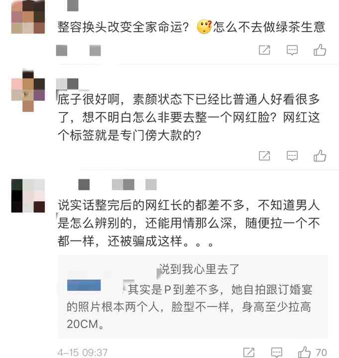 项思醒整容前照片遭扒？判若两人被嘲换头，传未婚夫坚定不退婚