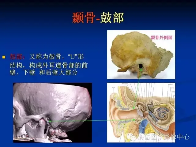 耳部CT及MRI解剖