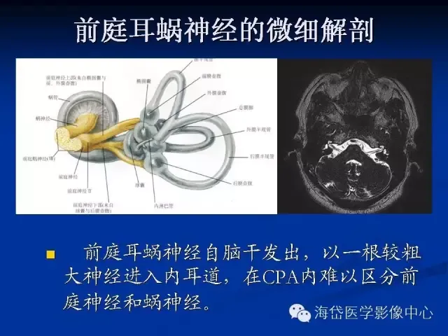 耳部CT及MRI解剖