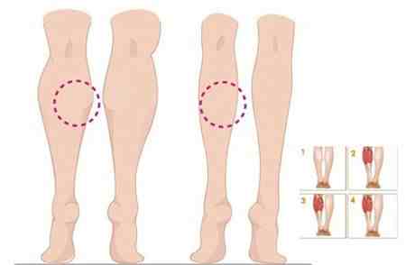 瘦腿针能保持多久？瘦腿针有什么副作用？
