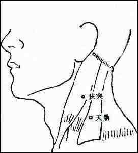 落枕颈椎痛怎么办快速缓解疼痛(落枕脖子痛怎么办？