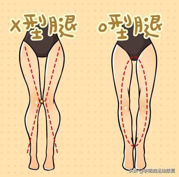 怎么瘦小腿|如何瘦小腿？