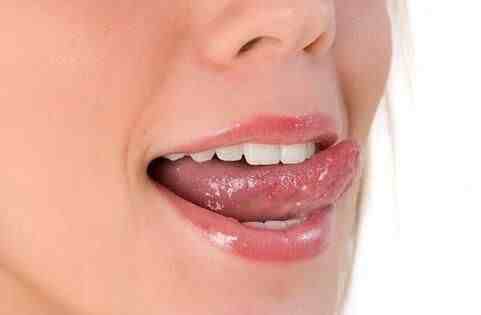 舌癌的早期症状|舌癌的早期症状有哪些