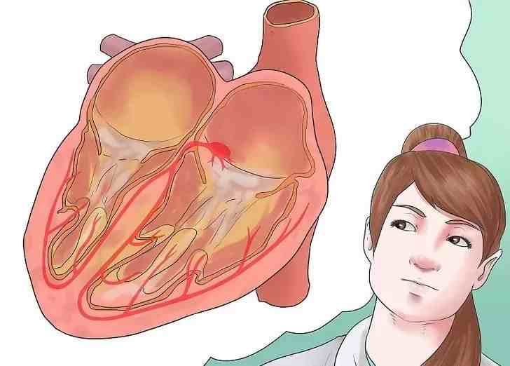 心肌梗塞的主要原因|引起心肌梗塞的原因有哪些？