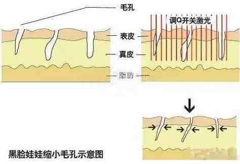 黑脸娃娃适合什么年龄做？|细说黑脸娃娃和白瓷娃娃