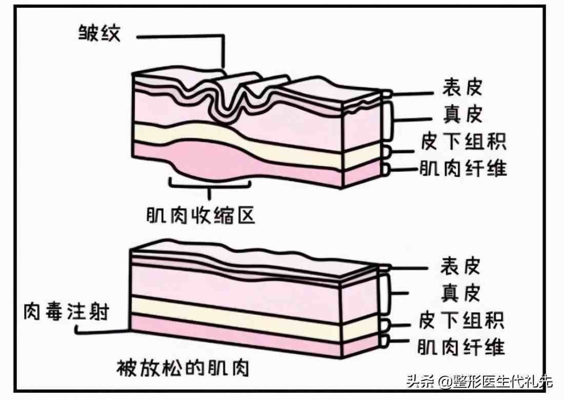 抬头纹怎么消？|有了抬头纹要怎么办？