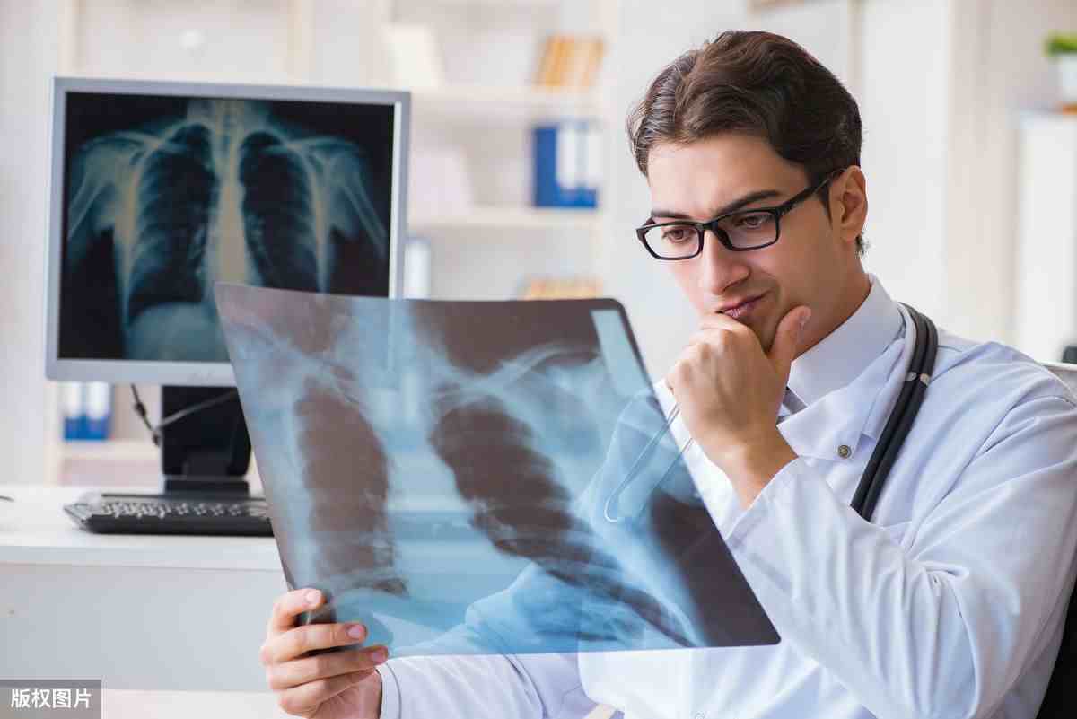 肺癌的五大治疗方式