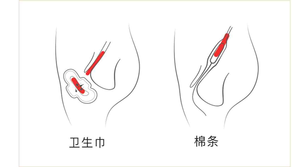 卫生棉条的正确使用方法