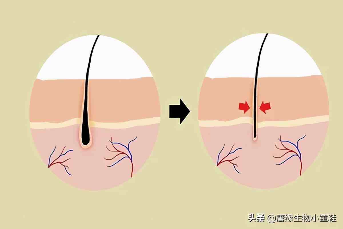 人为什么会脱发：脱发的真正原因