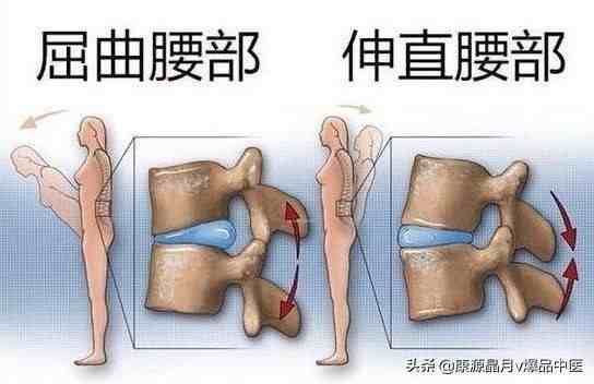 腰腿疼痛的真正原因是什么？为你总结腰腿疼痛大全