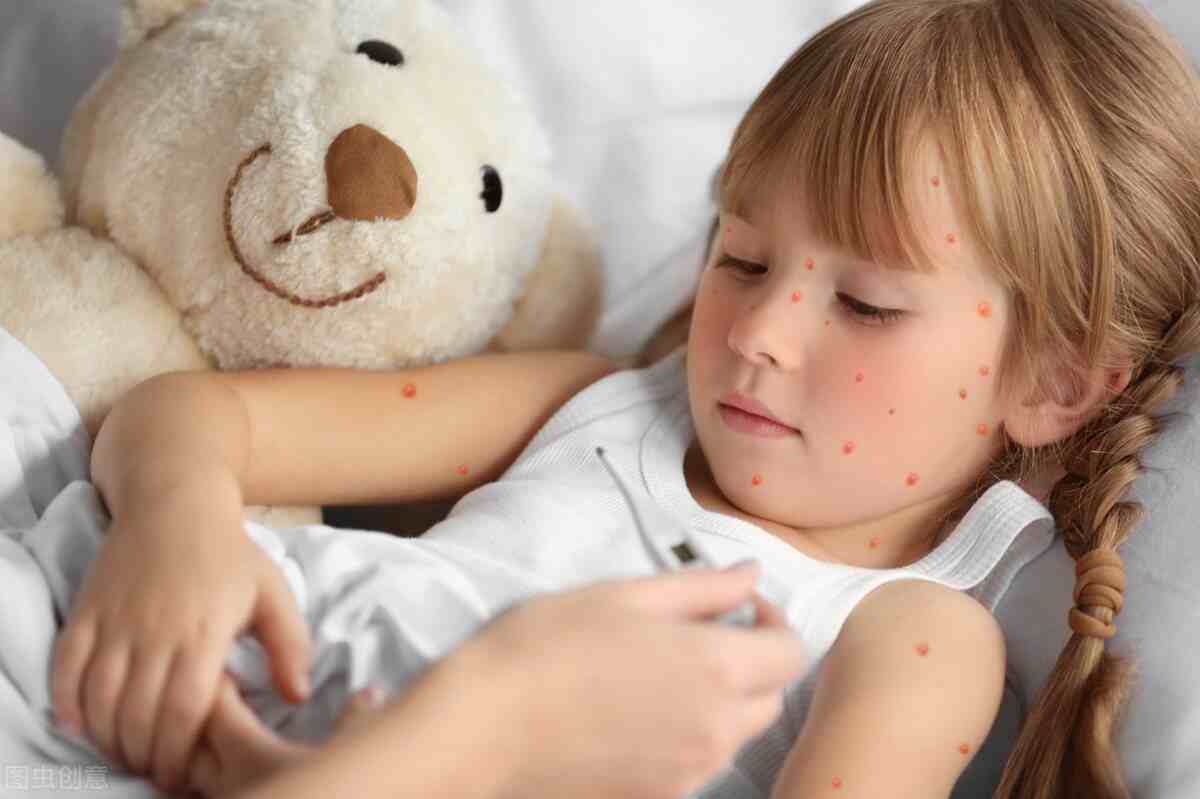 水痘的症状与治疗方法-水痘的症状