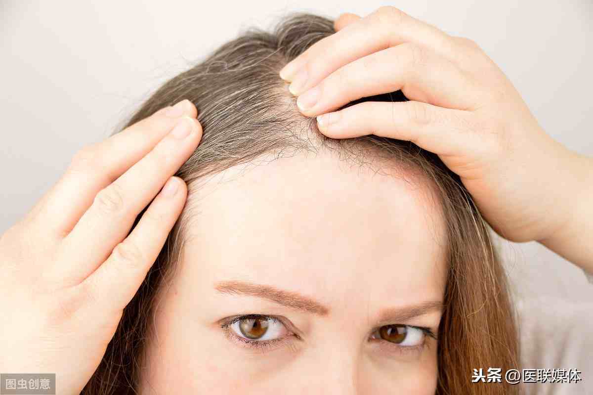 哪些原因导致白发出现？缓解头发变白，有三个方法