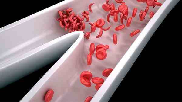 血红蛋白偏高是什么原因;会引起那种疾病危害