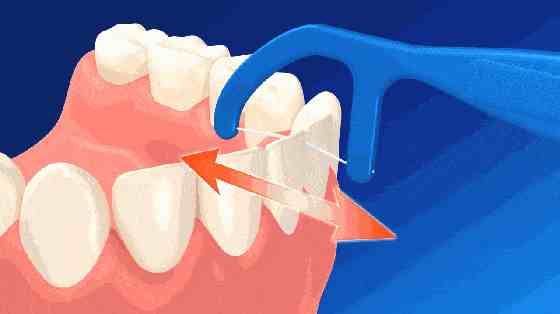 牙线的正确使用方法，你学会了吗？