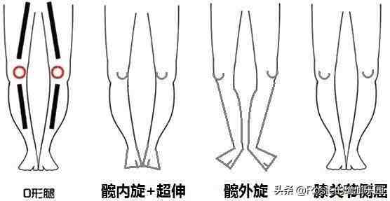 标准腿型|美腿的标准时什么？