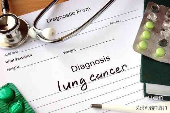 肺癌的早期症状|早期肺癌有什么症状