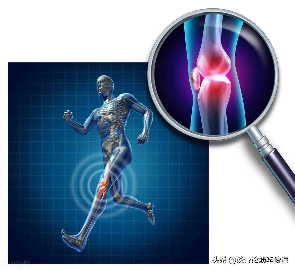 膝盖痛是什么原因|造成膝关节疼痛的原因有哪些？