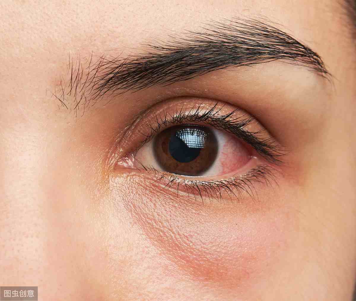 治疗病毒性角膜炎的常用眼药水有哪些？