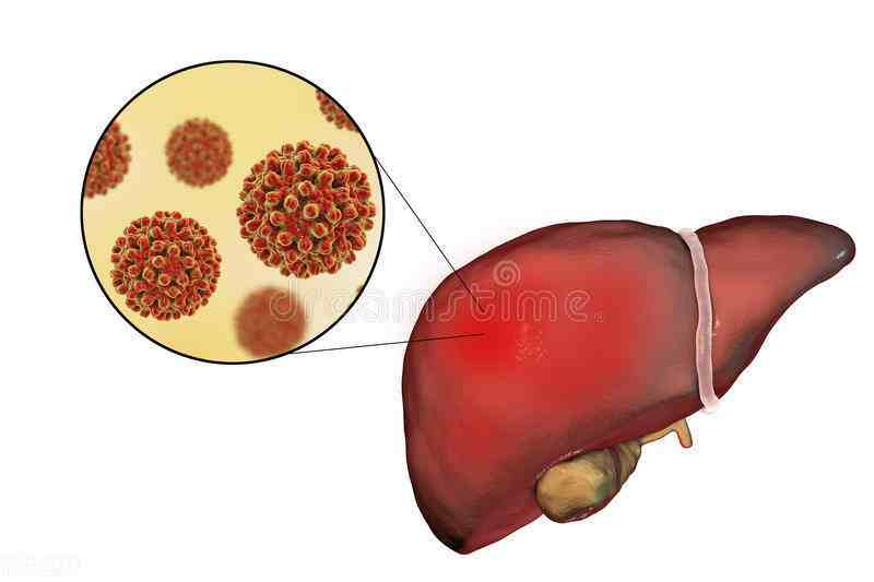 肝病症状|肝脏的症状表现多种多样