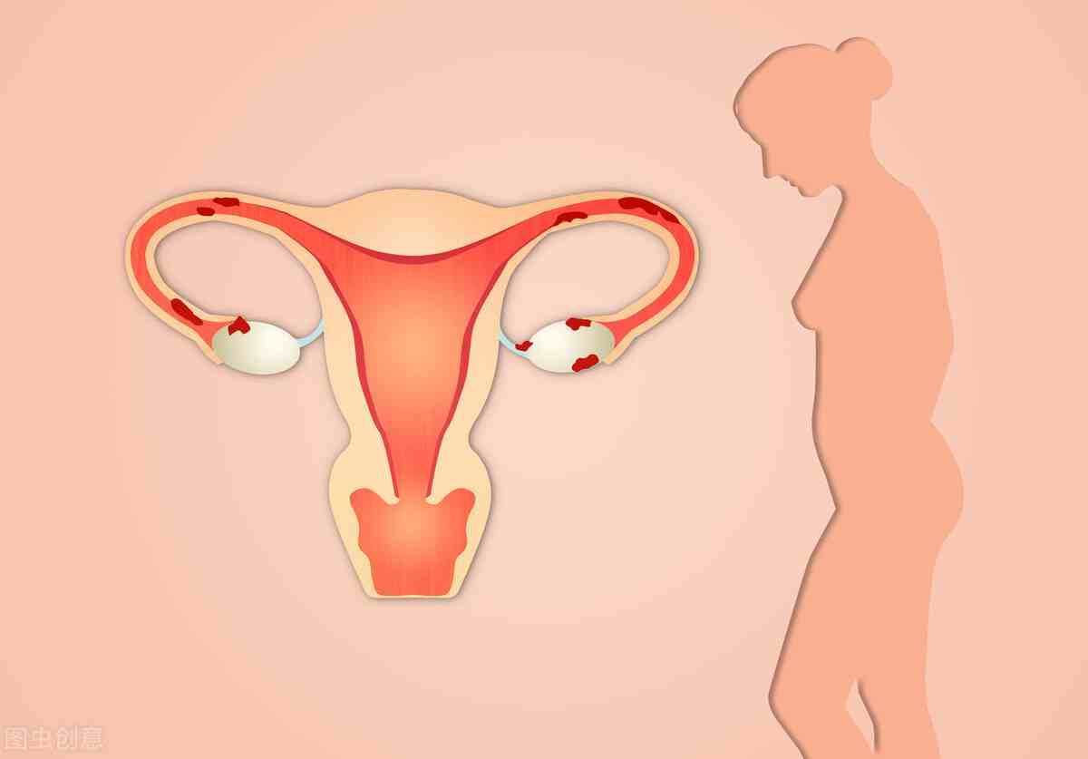 子宫肌瘤症状有哪些|子宫肌瘤的具体症状是什么？